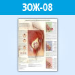 Плакат «Доброкачественные заболевания молочных желез» (ЗОЖ-08, пластик 2 мм, A1, 1 лист)